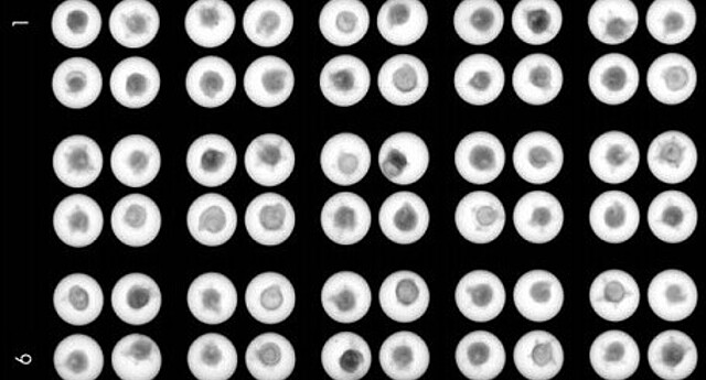 Strube 2D x-ray beet balls